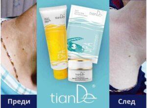 Пигментни петна бързо и ефективно премахване_TianDe_TianDeMy.Love_2