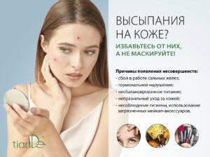 Лепенки за кожа склонна към акне_38811_TianDe_TianDeMy.love_1